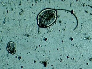 Morgellons under microscope 2