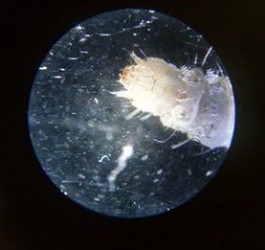 inchworm under microscope