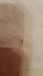 Brown Worm on Toilet Seat