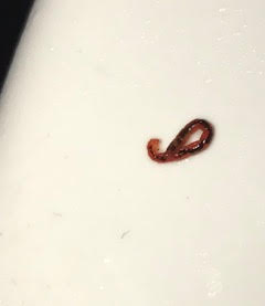 Red Worms in Pakistan Probably Just Earthworms