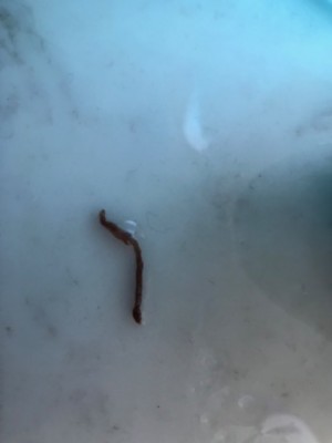 Worm In Shower Likely An Earthworm, Not A Parasite