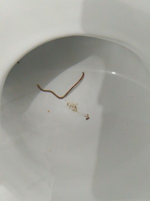Brown Worm in Toilet Probably An Earthworm