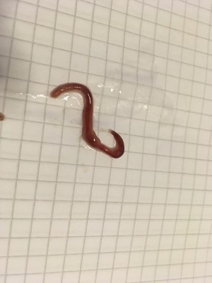 Earthworm or Intestinal Parasite?