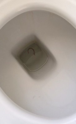 Worm In Toilet No Cause For Alarm