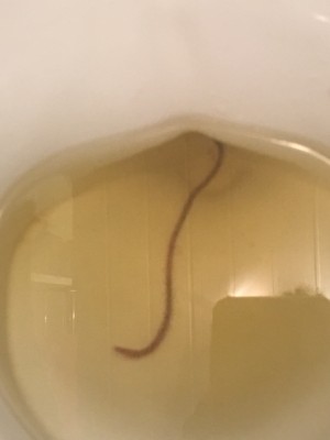 Worm In Toilet Probably Not From Reader's Body