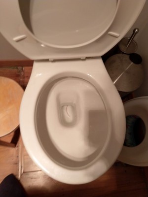 Worm in Toilet is Nothing to Worry About