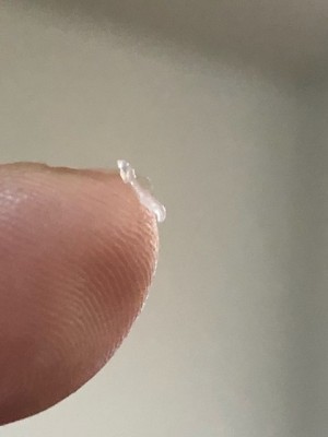 Reader Finds Clear Worm in His Cheek