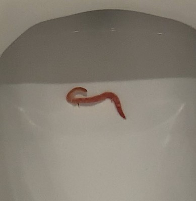 Uncertainties as to What This Pink Worm in Toilet is