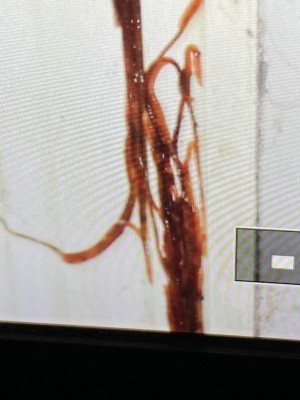 Hordes of Flat, Red Worms Infiltrate this Woman's Back Porch in Arkansas