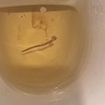 Pink Worm in Toilet is an Earthworm