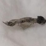 Gray-black Bug That Came Off Skin May be a Flea Larva