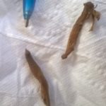 Rubbery, Splinter-like Worms Plague this Reader: Medical Parasitologist Resources Provided