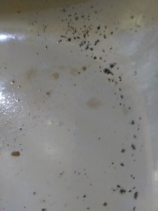 Black Dot-like Organism Found in Couch, Hair and Nails; Where This Woman Can Go For Help