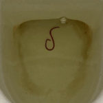 Red Worm Found in Toilet is an Earthworm