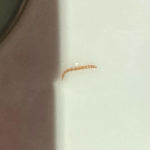 Red-striped Worm May be Bloodworm but Woman Worries About Parasites