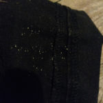 Small White Organisms Found on Pants in Yard Could be Anything from Clothes Moth Larvae to Something More Serious