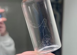 Parasites in Humans that Look Like Hair: Reader Discovers a Cure!