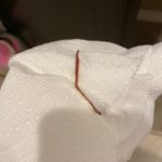 Earthworm Found Crawling Up the Wall of This Daughter’s Bedroom