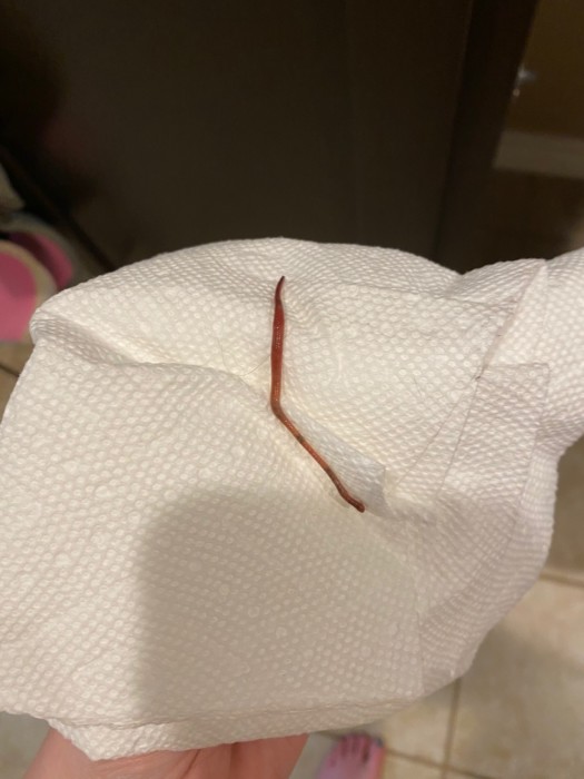Earthworm Found Crawling Up the Wall of This Daughter's Bedroom