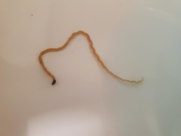 Long, Yellow, Squiggly Worm Found in Toilet is a Mystery