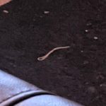 Woman “Tortured” by Long, White Worms Should Seek Medical Advice