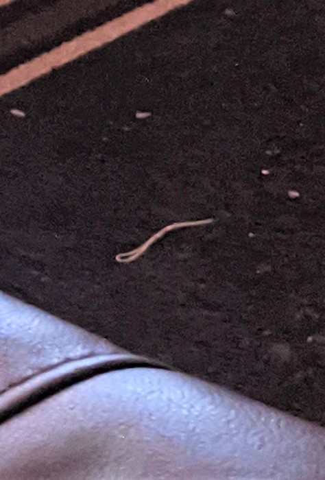 Woman "Tortured" by Long, White Worms Should Seek Medical Advice