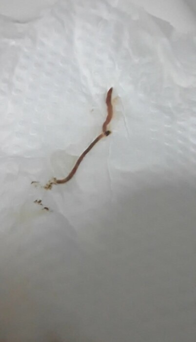 Tiny Pink Worms in Bathtub are Baby Earthworms