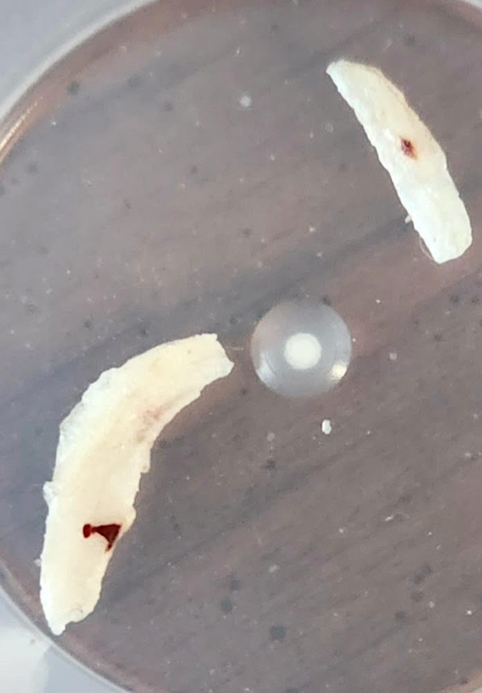 Jagged, White Organisms Found in Couch Might be Immature Red Triangle Slugs