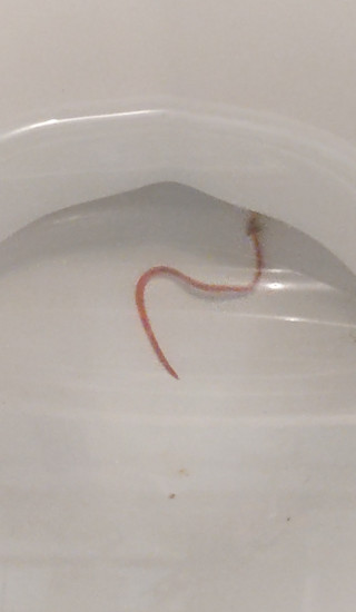 Red-striped Worm in Loo is a Bloodworm
