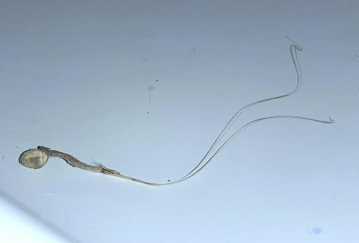 Stringy Worm in Washing Machine Needs a Medical Professional's Eye